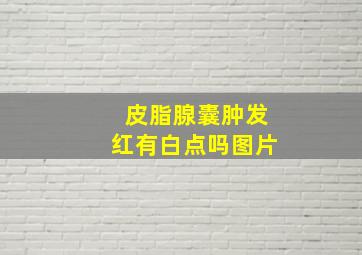 皮脂腺囊肿发红有白点吗图片