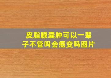 皮脂腺囊肿可以一辈子不管吗会癌变吗图片