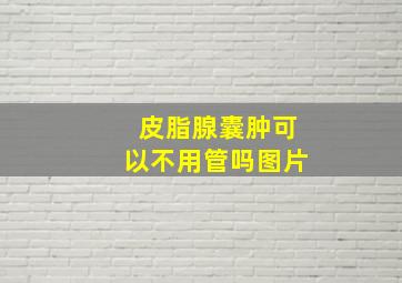 皮脂腺囊肿可以不用管吗图片