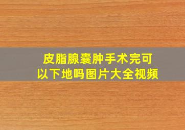 皮脂腺囊肿手术完可以下地吗图片大全视频