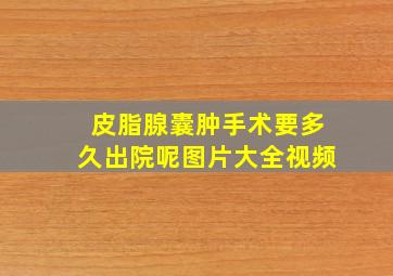 皮脂腺囊肿手术要多久出院呢图片大全视频