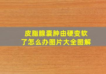 皮脂腺囊肿由硬变软了怎么办图片大全图解