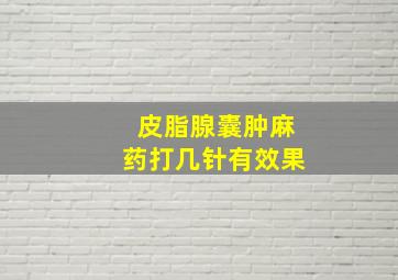 皮脂腺囊肿麻药打几针有效果