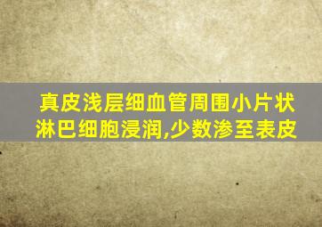 真皮浅层细血管周围小片状淋巴细胞浸润,少数渗至表皮