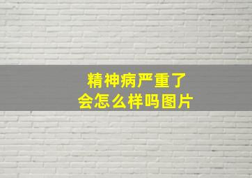 精神病严重了会怎么样吗图片