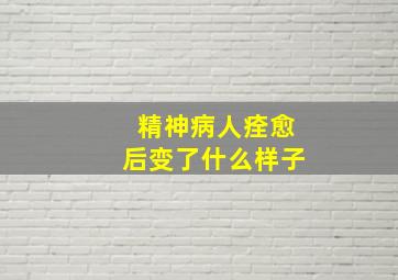 精神病人痊愈后变了什么样子