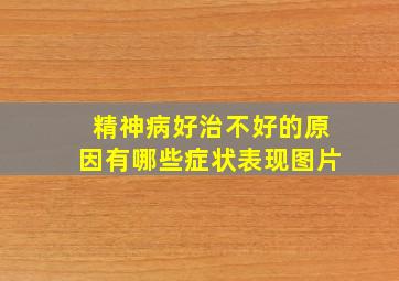 精神病好治不好的原因有哪些症状表现图片