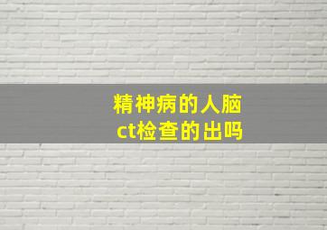 精神病的人脑ct检查的出吗