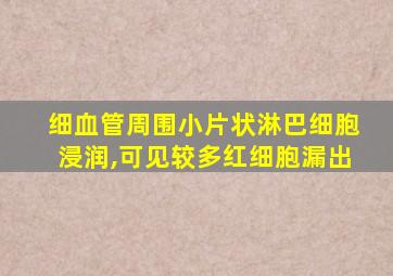 细血管周围小片状淋巴细胞浸润,可见较多红细胞漏出