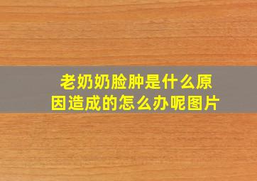 老奶奶脸肿是什么原因造成的怎么办呢图片