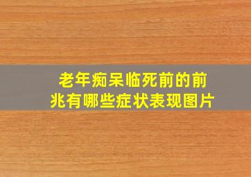 老年痴呆临死前的前兆有哪些症状表现图片