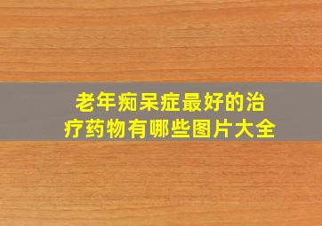 老年痴呆症最好的治疗药物有哪些图片大全