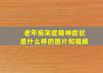 老年痴呆症精神症状是什么样的图片和视频