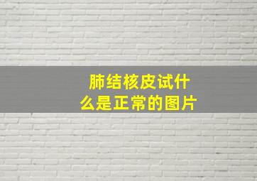 肺结核皮试什么是正常的图片