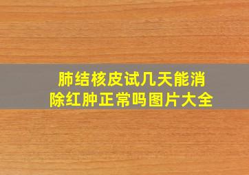 肺结核皮试几天能消除红肿正常吗图片大全