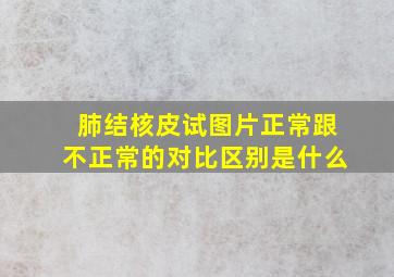 肺结核皮试图片正常跟不正常的对比区别是什么