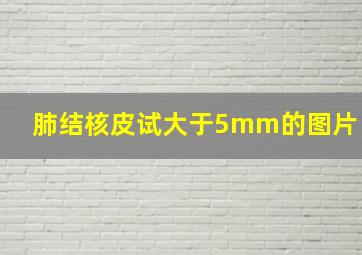 肺结核皮试大于5mm的图片