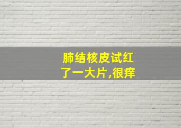 肺结核皮试红了一大片,很痒