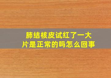 肺结核皮试红了一大片是正常的吗怎么回事