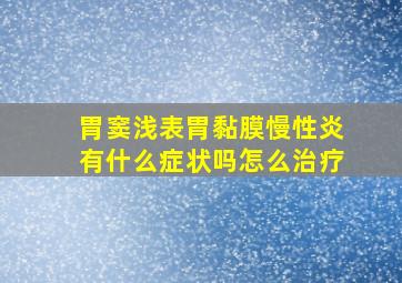 胃窦浅表胃黏膜慢性炎有什么症状吗怎么治疗