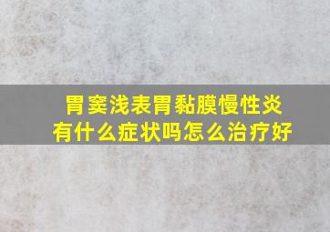 胃窦浅表胃黏膜慢性炎有什么症状吗怎么治疗好