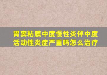 胃窦粘膜中度慢性炎伴中度活动性炎症严重吗怎么治疗