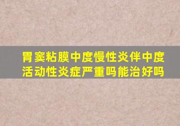 胃窦粘膜中度慢性炎伴中度活动性炎症严重吗能治好吗