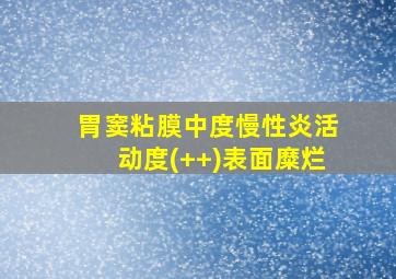 胃窦粘膜中度慢性炎活动度(++)表面糜烂