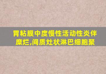 胃粘膜中度慢性活动性炎伴糜烂,间质灶状淋巴细胞聚