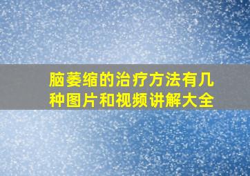 脑萎缩的治疗方法有几种图片和视频讲解大全