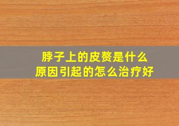 脖子上的皮赘是什么原因引起的怎么治疗好