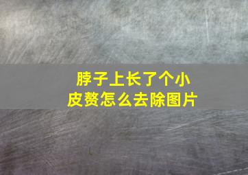 脖子上长了个小皮赘怎么去除图片