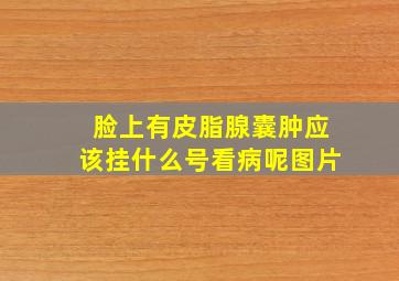 脸上有皮脂腺囊肿应该挂什么号看病呢图片