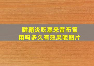 腱鞘炎吃塞来昔布管用吗多久有效果呢图片