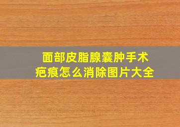 面部皮脂腺囊肿手术疤痕怎么消除图片大全