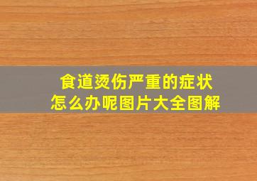 食道烫伤严重的症状怎么办呢图片大全图解