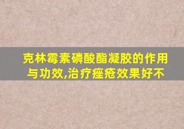 克林霉素磷酸酯凝胶的作用与功效,治疗痤疮效果好不