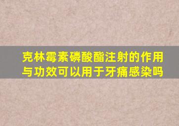 克林霉素磷酸酯注射的作用与功效可以用于牙痛感染吗