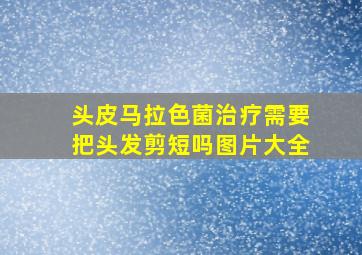 头皮马拉色菌治疗需要把头发剪短吗图片大全