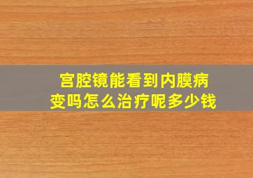 宫腔镜能看到内膜病变吗怎么治疗呢多少钱