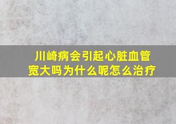 川崎病会引起心脏血管宽大吗为什么呢怎么治疗