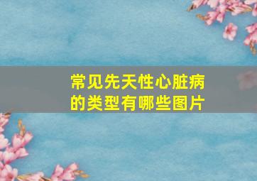 常见先天性心脏病的类型有哪些图片