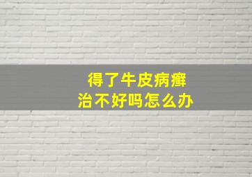 得了牛皮病癣治不好吗怎么办