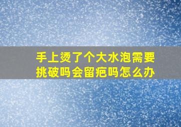 手上烫了个大水泡需要挑破吗会留疤吗怎么办