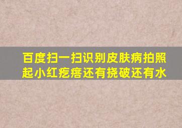 百度扫一扫识别皮肤病拍照起小红疙瘩还有挠破还有水