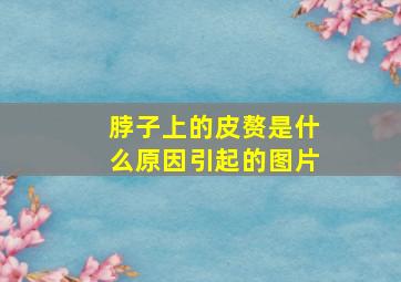 脖子上的皮赘是什么原因引起的图片