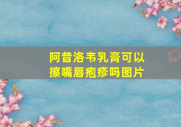 阿昔洛韦乳膏可以擦嘴唇疱疹吗图片