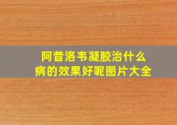 阿昔洛韦凝胶治什么病的效果好呢图片大全