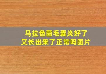 马拉色菌毛囊炎好了又长出来了正常吗图片