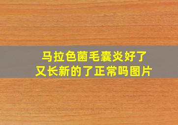 马拉色菌毛囊炎好了又长新的了正常吗图片